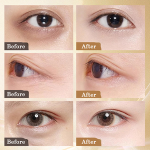 Huile de soin des yeux anti-rides Private Label Essence Traitement de massage quotidien pour les ridules et l'humidité autour des yeux Forme de crème - Product Image 4