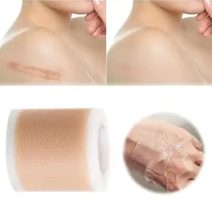 En gros, Bandes adhésives en silicone pour cicatrices, douces, réutilisables, en feuilles, pour la beauté - Product Image 3