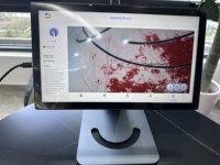 Analyseur de cuir chevelu intelligent, 7 indicateurs de test, recommandation automatique de produits