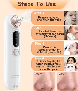 Portable Vacuum Blackhead Remover 4 Suction Heads Adjustable USB Rechargeable Waterproof <b>Pore</b> <b>Cleaner</b> - Product Image 2