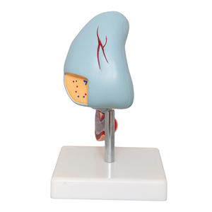 Fabriek Menselijke Milt Model Viscerale Alvleesklierfunctie Alvleesklier Milt Lever Galblaas Duodenum Model <span class=keywords><strong>Pancreas</strong></span> Model - Product Image 5