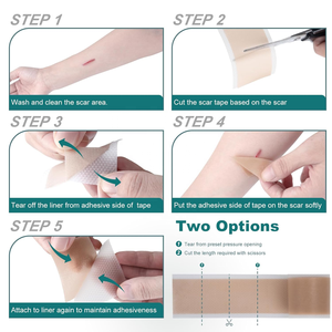 OEM ODM Patch en Silicone Contre les Cicatrices, Bande de Gel Chirurgical pour l'Élimination <span class=keywords><strong>Efficace</strong></span> des Cicatrices Bucco-Nasales et Corporelles - Product Image 5