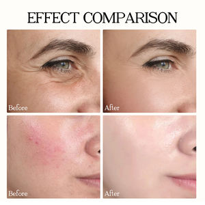 Korea Vegetal Ginkgo Light & Bouncy Water Cream Hidratante Iluminador y Reafirmante Reparación Piel sensible roja con ácido hialurónico - Product Image 2