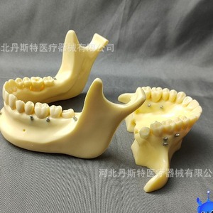 รูปแบบการสอนทันตกรรม DT M2016 PLA วัสดุเทียมที่ยึดเพื่อการศึกษา - Product Image 4