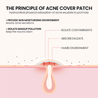 Patchs Anti-Acné Hydrocolloïdes OEM 200 Pièces Soin Coréen Cicatrisant pour Boutons