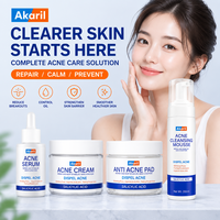 Akaril Kit Complet Anti-Acné : Sérum, Crème, Mousse et Tampons à l'Acide Salicylique – 4 Étapes pour Réduire les Pores, Atténuer les Éruptions Cutanées et Estomper les Cicatrices