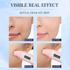 Masque facial en feuille de perle de pêche et <span class=keywords><strong>d</strong></span>'<span class=keywords><strong>escargot</strong></span>, soin du visage, hydratant, beurre de karité, camomille, acide hyaluronique - Product Image 4