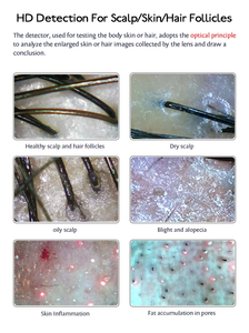 Analizador de Cuero Cabelludo y Cabello con Doble Sonda 50X 200X, Detector de Folículos Pilosos, Máquina Analizadora de Cuero Cabelludo - Product Image 6