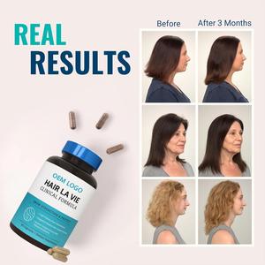 Vitamina para el Crecimiento del Cabello La Vie Live Conscious Clinical Formula para Mujeres y Hombres con Biotina, Colágeno y Saw Palmetto - Product Image 3