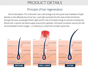 Free Tax Bioelectric <b>Vibration</b> Hair Care Machine Improving Hair Growth Environment and Preventing Hair Loss - Product Image 2