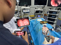 Caméra endoscopique sans fil 4K à faible latence avec batterie détachable longue durée pour chirurgie hospitalière ORL, urologie, cystoscopie et endoscopie