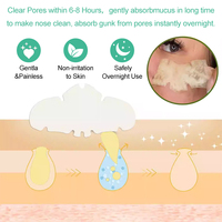 Patch nasal hydrocolloïde végétalien biodégradable dissolvant de tête noire nettoyant hydrocolloïde pores de points noirs patch de dissolvant de bandelettes nasales