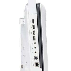 SonoScape E2 Ultrassom Doppler/Diagnóstico Ultrassom Portátil Ultrassom Scanner para Ser Humano - Product Image 3