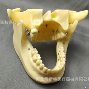 รูปแบบการสอนทันตกรรม DT M2016 PLA วัสดุเทียมที่ยึดเพื่อการศึกษา - Product Image 1