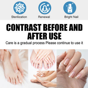 <span class=keywords><strong>SunM</strong></span> Cross-Border Onychomycosis Pen Care Liquid Nail Hydratant Repair Herbal Foot Use - Product Image 2