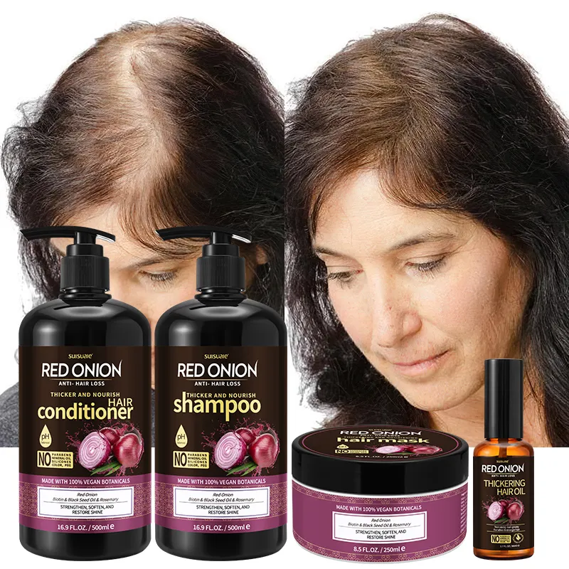 Private Label sano naturale organico cura dei capelli crescita Anti perdita di capelli cipolla Set per la cura dei capelli Shampoo e balsamo crema olio Set