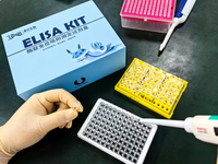 Kit ELISA de Antígeno Prostático Específico (PSA) de Rata para Uso en Investigación, para Medir Niveles de PSA en Muestras de Suero y Plasma de Rata