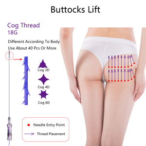 CE Kolajen Çift Yönlü Gerdirici İplikler Dikenli Yanak Yüz Germe 19g 100mm Künt L Kanül <span class=keywords><strong>Pdo</strong></span> <span class=keywords><strong>Cog</strong></span> 4D İplikler - Product Image 6