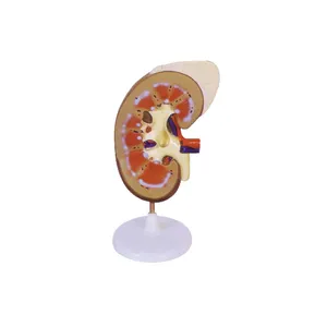 50109.02 Model of Human Kidney with Adrenal Gland