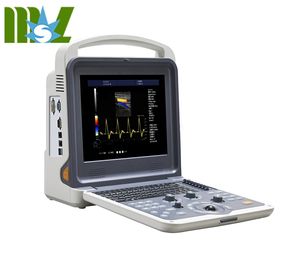 Volledige Digitale Draagbare Kleur <span class=keywords><strong>Doppler</strong></span> Ultrasound Machine Prijs - Product Image 2