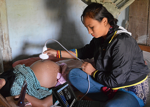 Cor animal sem fio doppler sonda linear ecocardiografia ultra-som máquina - Product Image 4