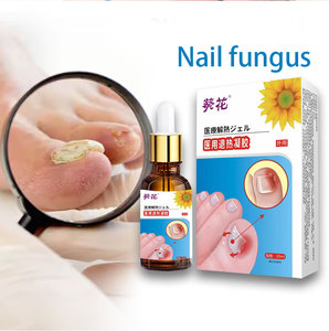 Kuihua mụn trứng cá lỗ chân lông viêm Gel giúp làm giảm và cải thiện mụn trứng cá mọc ngược móng tay và teo - Product Image 2