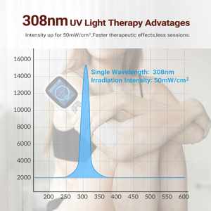 Uv terapi cahaya Ultraviolet solusi efektif tinggi 308nm Excimer Uvb Laser Vitiligo dan perawatan untuk gangguan kulit - Product Image 4
