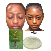 Savon éclaircissant pour l'acné et les taches noires de marque privée Traitement efficace de la pigmentation de la peau éclaircissant le teint uniforme