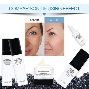 Set di Cura della Pelle Coreano OEM con Caviale di Storione Biologico, Detergente Viso Sbiancante Anti-Età, Siero, Lozione, Crema e Siero per Occhi - Product Image 5