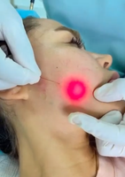 Top vente amincissant l'enlèvement graisse 980nm Diode Laser liposuccion chirurgie Machine Laser lipolyse dispositif