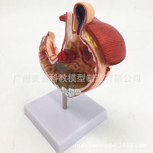 Modèle de simulation pédagogique d'estomac pathologique, modèle d'anatomie d'estomac pathologique, spécimens d'anatomie viscérale et un autre modèle. - Product Image 4
