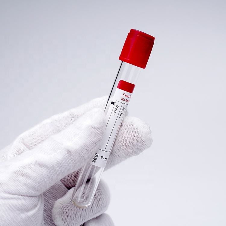 Ce Vacuum Blood Collection Vacutainer Tubes