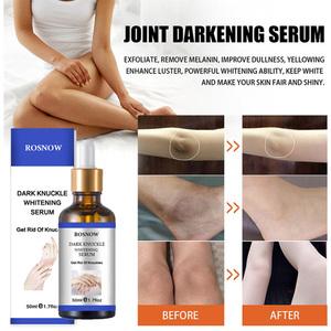 <span class=keywords><strong>Precio</strong></span> de fábrica Crema para nudillos oscuros Codos y rodillas Suero blanqueador rápido fuerte - Product Image 6