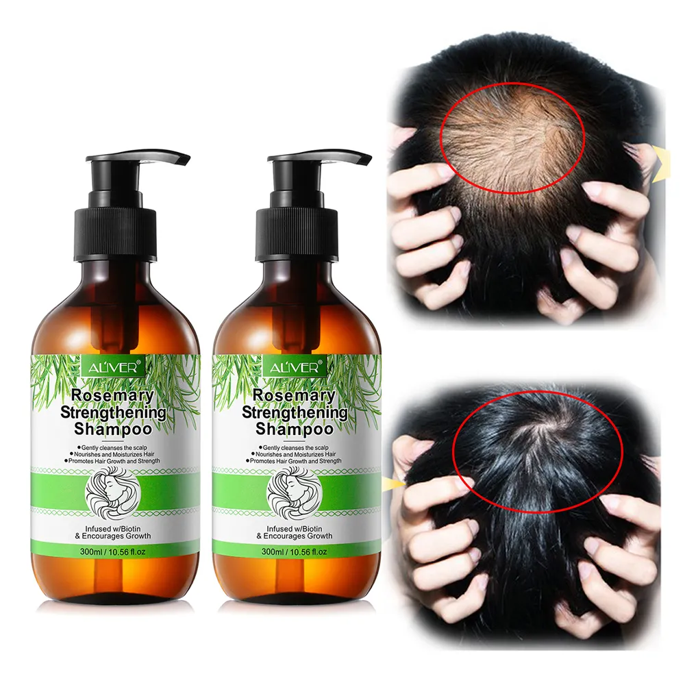 ALIVER vente en gros 300ml Anti-perte de cheveux shampooing OEM bio végétalien biotine croissance des cheveux romarin menthe renforcement huile shampooing