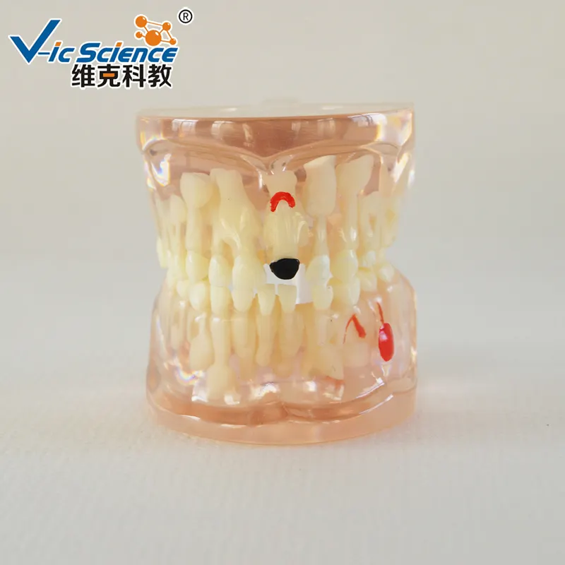 Modelo de dientes deciduos permanentes mixtos transparentes de siete años humanos de tamaño natural tipo Nissin