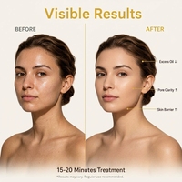 Mascarilla Facial de Ácido Salicílico y Ectoína para el Alivio del Acné, Control de Grasa, Aclarante, Reparación de la Barrera Cutánea, Hidratación Profunda
