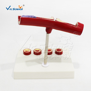 Modelo cardiovascular humano, modelo de trombosis patológica - Product Image 2