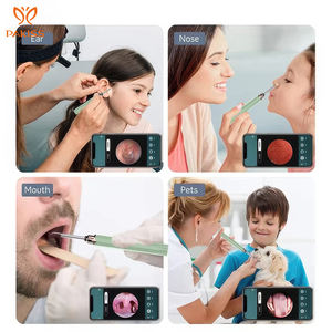 Pakiss – dissolvant de cire d'oreille portable en acier inoxydable avec appareil photo, aspirateur d'oreille, dissolvant de cire, cure-oreille, vente en gros - Product Image 6