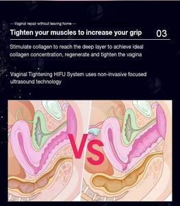 Mejor Máquina Mini <span class=keywords><strong>HIFU</strong></span> Corporal 3.0mm 4.5mm Terapia Focal <span class=keywords><strong>HIFU</strong></span> Ultrasonido Focalizado de Alta Intensidad Cuidado de Reafirmación Vaginal para Salón - Product Image 3
