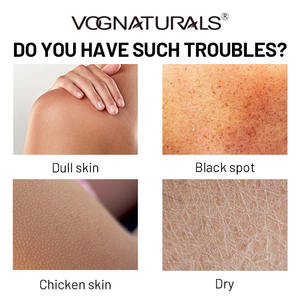 Jabón Natural de Cúrcuma con Miel Calmante, Jabón en Barra de Cúrcuma para Rostro <span class=keywords><strong>y</strong></span> Cuerpo, Reduce el Enrojecimiento, Atenúa las Manchas de la Edad - Product Image 5