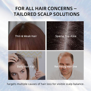 OEM cairan penumbuh rambut kondisioner minyak Revitalisasi rambut perawatan kulit kepala Anti rambut rontok perawatan esensi Serum penebal rambut - Product Image 5