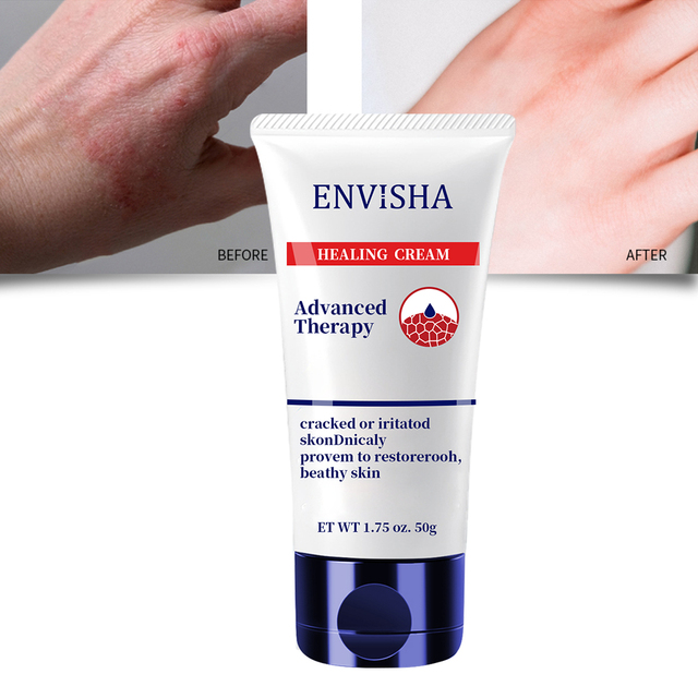 OEM Hand Feet Dry Cracked Skin Moisturizing Healing Ointment Skin Protectant Cream