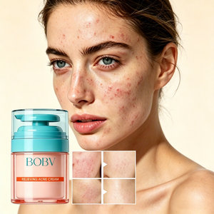 Crème Visage Anti-Acné aux Herbes : Apaise, Atténue les Cicatrices d'Acné, Contrôle le Sébum, Hydrate, Anti-Rides pour Tous Types de Peau - Product Image 2