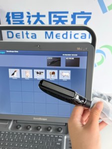 Sistema de Ultrasonido Doppler Color Veterinario Sonoscape S8 ExpV con Puertos Dobles para Sondas, para Exámenes Clínicos de Animales de Granja y Mascotas - Product Image 5
