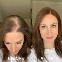 Vitamines pour la croissance des cheveux pour femmes, biotine 10 000 mcg, collagène et palmier nain, favorisent des cheveux, une peau et des ongles plus forts et plus sains
