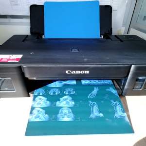 卸売医療ブルーインクジェット半透明フィルムX線CT、CR、DR、MTR、PET-CT A4 A3 8 "* 10" 14 "* 17" 医療イメージング印刷 - Product Image 4