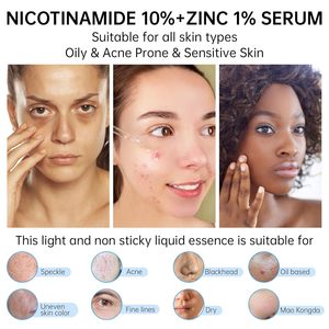 ETRUN ALISA - Suero Facial con Niacinamida al <span class=keywords><strong>10</strong></span>% y <span class=keywords><strong>Zinc</strong></span> al <span class=keywords><strong>1</strong></span>%, Suero de Niacinamida para el Rostro, Alivia el Enrojecimiento, 30 ml - Product Image 4