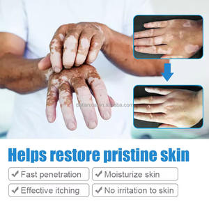 Psoriasis Localizado Vitiligo Ungüento Micosis Leukoplakia Localizado Vitiligo Ungüento <span class=keywords><strong>Tratamiento</strong></span> - Product Image 3