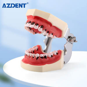 <span class=keywords><strong>Model</strong></span> Pengajaran Gigi Azdent <span class=keywords><strong>Model</strong></span> Kalkulus Gigi/ <span class=keywords><strong>Model</strong></span> Penyakit <span class=keywords><strong>Periodontal</strong></span> - Product Image 5