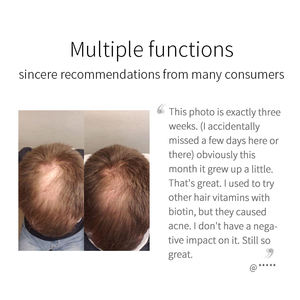 Riz noir naturel Nourrir le follicule Anti-chute de cheveux Spray de croissance des cheveux 50ml Convient aux cheveux clairsemés - Product Image 5